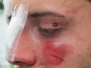 Violência contra Homossexuais