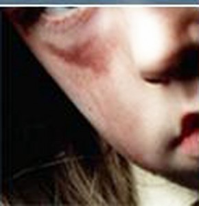 Prevenção da Violência Infantil e Intrafamiliar: Estatuto da Criança e do Adolescente